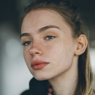 Kaip įveikti paaugliškas odos problemas? Išsamus gidas ir patarimai